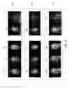 Fig. 07 - SYSTEM AND METHOD FOR MAGNETIC RESONANCE IMAGING AN OBJECT WITH A PLURALITY OF READOUT GRADIENT AMPLITUDES