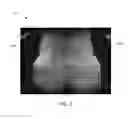 Fig. 08 - SYSTEM AND METHOD FOR MAGNETIC RESONANCE IMAGING AN OBJECT WITH A PLURALITY OF READOUT GRADIENT AMPLITUDES