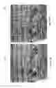Fig. 05 - Line and edge detection and enhancement