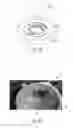 Fig. 14 - Imaging systems with micro optical element arrays and methods of specimen imaging