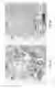 Fig. 15 - Imaging systems with micro optical element arrays and methods of specimen imaging