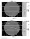 Fig. 05 - Apparatus and techniques for beam mapping in ion beam system