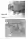 Fig. 30 - Preparing anodes for lithium ion cells from aluminum anode active material particles