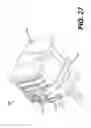 Fig. 28 - Lock-in securable electrical plug adapter and method of use