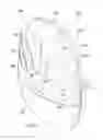 Fig. 02 - Heated insect trapping device and methods thereof