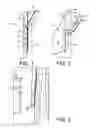 Fig. 02 - Zipper closure facilitator assembly for articles of apparel