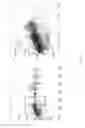 Fig. 06 - Device and method for measuring viewing distances