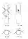 Fig. 03 - Collapsible tube for hemostasis