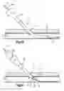 Fig. 03 - Vascular locating systems and methods of use