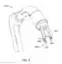 Fig. 09 - Intraoral stapler