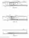 Fig. 08 - Clot removal device and method of using same