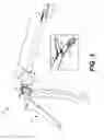 Fig. 02 - TRANSAPICAL DELIVERY MITRAL VALVE PROCEDURE DEVICES