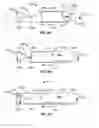 Fig. 04 - Thrombectomy catheter