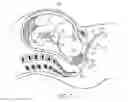 Fig. 08 - Fetus delivery assisting device