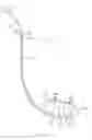 Fig. 10 - Fetus delivery assisting device