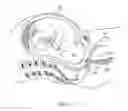Fig. 12 - Fetus delivery assisting device