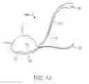 Fig. 14 - Fetus delivery assisting device