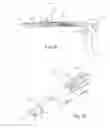 Fig. 43 - Method and apparatus for performing spinal surgery