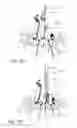 Fig. 49 - Method and apparatus for performing spinal surgery
