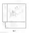 Fig. 02 - Cryoablation system with magnetic resonance imaging detection