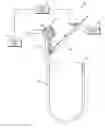 Fig. 01 - FISTULA CREATION FOR FLUID DRAINAGE