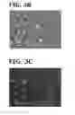 Fig. 04 - DENTAL PROSTHESIS AND COMPONENT THEREOF