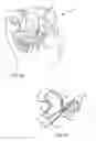 Fig. 02 - System and method for delivering an embolic device