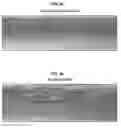 Fig. 09 - Soft tissue repair allografts and methods for preparing same