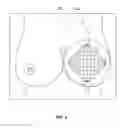 Fig. 06 - Mesh pouch for medical implant and method for using same
