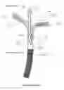 Fig. 04 - Tissue grasping devices and related methods