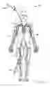 Fig. 02 - Introducer systems, devices and methods for heart valve reductions