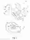 Fig. 02 - TOTAL KNEE IMPLANT PROSTHESIS ASSEMBLY AND METHOD