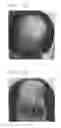 Fig. 02 - METHOD FOR PRODUCING TOPICAL COMPOSITION FOR HAIR-LOSS PREVENTION AND HAIR GROWTH