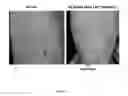 Fig. 02 - TREATING ACTIVATED DERMAL CONDITIONS WITH AGENTS THAT TARGET ENERGY METABOLISM