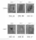 Fig. 02 - METHODS OF DEBRIDEMENT OF CHRONIC WOUNDS
