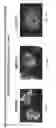 Fig. 07 - COMBINATION THERAPY FOR INDUCING IMMUNE RESPONSE TO DISEASE