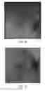 Fig. 06 - EVASION OF NEUTRALIZING ANTIBODIES BY A RECOMBINANT ADENO-ASSOCIATED VIRUS