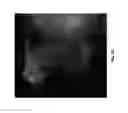 Fig. 23 - SCAFFOLDS FABRICATED FROM ELECTROSPUN DECELLULARIZED EXTRACELLULAR MATRIX