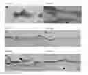 Fig. 08 - Muscle cell patches and uses therefor