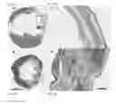 Fig. 09 - Muscle cell patches and uses therefor
