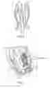 Fig. 07 - Ventricular assist device stent, ventricular assist device, and related methods thereof