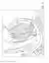 Fig. 08 - Ventricular assist device stent, ventricular assist device, and related methods thereof