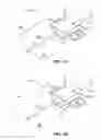 Fig. 02 - Systems and methods for automatic termination of flow due to needle dislodgement