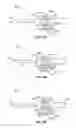Fig. 09 - Systems and methods for automatic termination of flow due to needle dislodgement