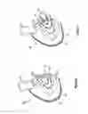 Fig. 07 - Mask