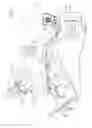 Fig. 02 - Catheter handle