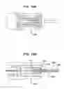 Fig. 09 - Devices and method for maxillary sinus lavage