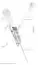 Fig. 02 - Catheter insertion device
