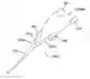 Fig. 01 - Autologous pleurodesis methods and devices