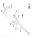Fig. 07 - Autologous pleurodesis methods and devices